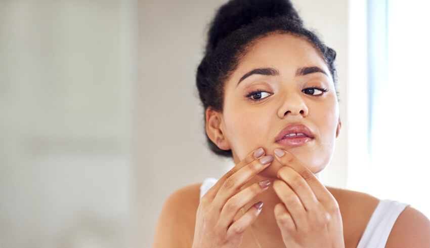 6 Foods To Avoid That Might Be Causing You Acne